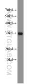 Spindlin 1 antibody, 12105-1-AP, Proteintech Group, Western Blot image 