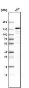 Serine/threonine-protein kinase PRP4 homolog antibody, HPA020638, Atlas Antibodies, Western Blot image 