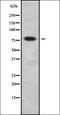 SET Domain And Mariner Transposase Fusion Gene antibody, orb336303, Biorbyt, Western Blot image 