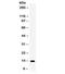 S100 Calcium Binding Protein A9 antibody, R32068, NSJ Bioreagents, Western Blot image 