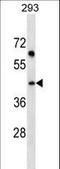 Stromal Cell Derived Factor 4 antibody, LS-C158932, Lifespan Biosciences, Western Blot image 