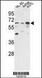 Protein Phosphatase 3 Catalytic Subunit Gamma antibody, 63-486, ProSci, Western Blot image 