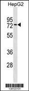 Zinc Finger Protein 614 antibody, 59-925, ProSci, Western Blot image 