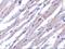 BCL2 Like 13 antibody, A06151, Boster Biological Technology, Immunohistochemistry paraffin image 