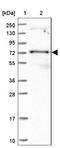 Pseudouridine Synthase 10 antibody, NBP2-48941, Novus Biologicals, Western Blot image 