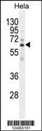 Hyaluronidase 2 antibody, 55-374, ProSci, Western Blot image 