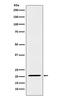 Interleukin 23 Subunit Alpha antibody, M01097, Boster Biological Technology, Western Blot image 