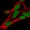 Homeobox A9 antibody, HPA061982, Atlas Antibodies, Immunofluorescence image 