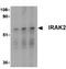 Interleukin-1 receptor-associated kinase-like 2 antibody, ab62419, Abcam, Western Blot image 