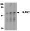 Interleukin 1 Receptor Associated Kinase 2 antibody, ab62419, Abcam, Western Blot image 