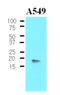 Protein Phosphatase 1 Regulatory Inhibitor Subunit 14A antibody, AM03185PU-S, Origene, Western Blot image 