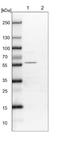 STE20 Related Adaptor Beta antibody, NBP1-90183, Novus Biologicals, Western Blot image 