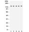 Transient Receptor Potential Cation Channel Subfamily M Member 8 antibody, R32272, NSJ Bioreagents, Western Blot image 