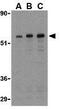 TGF-Beta Activated Kinase 1 (MAP3K7) Binding Protein 1 antibody, GTX31691, GeneTex, Western Blot image 