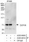 Decapping MRNA 1B antibody, A303-641A, Bethyl Labs, Immunoprecipitation image 