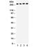 Calcium Voltage-Gated Channel Subunit Alpha1 F antibody, R31827, NSJ Bioreagents, Western Blot image 