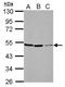 Phosphatidylinositol-5-Phosphate 4-Kinase Type 2 Alpha antibody, NBP2-19834, Novus Biologicals, Western Blot image 