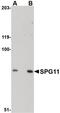 SPG11 Vesicle Trafficking Associated, Spatacsin antibody, PA5-20683, Invitrogen Antibodies, Western Blot image 