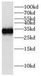 Glutamate-Cysteine Ligase Modifier Subunit antibody, FNab03387, FineTest, Western Blot image 