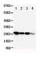 FGF1 antibody, RP1005, Boster Biological Technology, Western Blot image 