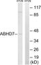 Epoxide Hydrolase 4 antibody, LS-C119683, Lifespan Biosciences, Western Blot image 