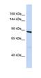 Ferritin Light Chain antibody, orb330742, Biorbyt, Western Blot image 