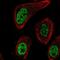 Monoglyceride Lipase antibody, NBP2-55204, Novus Biologicals, Immunofluorescence image 