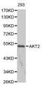 AKT Serine/Threonine Kinase 2 antibody, LS-C192657, Lifespan Biosciences, Western Blot image 