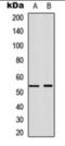 Annexin A7 antibody, orb360744, Biorbyt, Western Blot image 