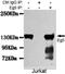 Kinesin Family Member 11 antibody, GTX49188, GeneTex, Immunoprecipitation image 