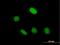 Zinc Finger And BTB Domain Containing 49 antibody, H00166793-B01P, Novus Biologicals, Immunocytochemistry image 