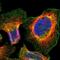 Trichomonas vaginalis p65 antibody, NBP1-89196, Novus Biologicals, Immunofluorescence image 