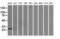 Hydroxysteroid 17-Beta Dehydrogenase 10 antibody, M03844-2, Boster Biological Technology, Western Blot image 