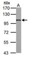Adaptor Related Protein Complex 2 Subunit Beta 1 antibody, NBP2-15563, Novus Biologicals, Western Blot image 
