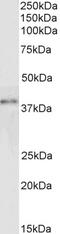 GRB2 Related Adaptor Protein 2 antibody, 45-705, ProSci, Enzyme Linked Immunosorbent Assay image 