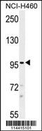 Transient Receptor Potential Cation Channel Subfamily M Member 8 antibody, 55-973, ProSci, Western Blot image 