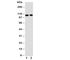 Transient Receptor Potential Cation Channel Subfamily C Member 6 antibody, R30847, NSJ Bioreagents, Western Blot image 