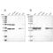 Pyrophosphatase (Inorganic) 2 antibody, NBP2-38186, Novus Biologicals, Western Blot image 