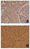 HIF1-alpha antibody, NB100-131, Novus Biologicals, Immunohistochemistry frozen image 