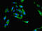 Methylenetetrahydrofolate Reductase antibody, CSB-PA015158LA01HU, Cusabio, Immunofluorescence image 