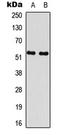 Ribosomal Protein S6 Kinase B2 antibody, LS-C368506, Lifespan Biosciences, Western Blot image 