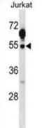 C-Terminal Src Kinase antibody, abx028762, Abbexa, Western Blot image 