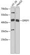 Dipeptidase 1 antibody, GTX54046, GeneTex, Western Blot image 