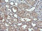 DExD/H-Box Helicase 58 antibody, LS-C174735, Lifespan Biosciences, Immunohistochemistry paraffin image 