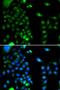 Ubiquitin Conjugating Enzyme E2 J2 antibody, LS-C346357, Lifespan Biosciences, Immunohistochemistry frozen image 