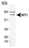 WT1 Transcription Factor antibody, MA1-46028, Invitrogen Antibodies, Western Blot image 