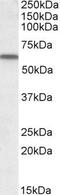 GC Vitamin D Binding Protein antibody, PA5-18795, Invitrogen Antibodies, Western Blot image 