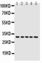 Caspase 6 antibody, PA5-78922, Invitrogen Antibodies, Western Blot image 