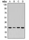 Syntaxin 8 antibody, LS-C668516, Lifespan Biosciences, Western Blot image 