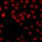 ATM Interactor antibody, LS-C668932, Lifespan Biosciences, Immunofluorescence image 